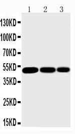IKBKG / NEMO / IKK Gamma Antibody (aa1-15)