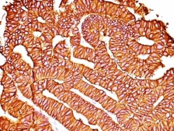 EPCAM Antibody (aa27-59, clone SPM528)