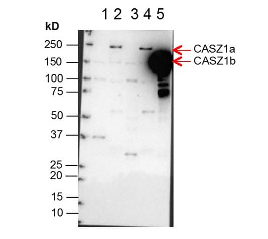 CASZ1 Antibody