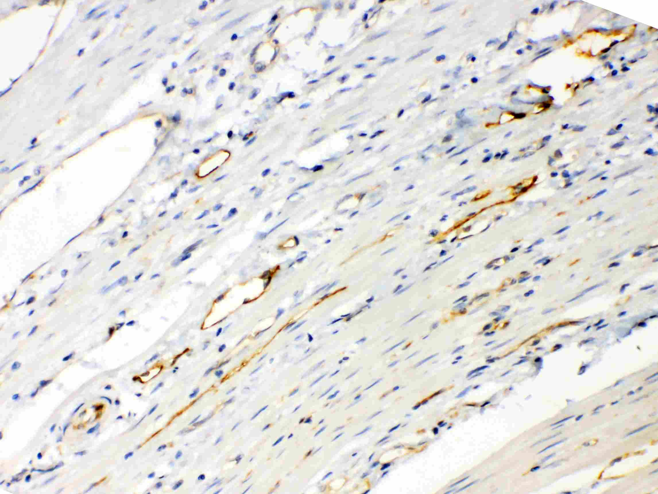 Polyclonal Rabbit anti-Human ANGPTL2 / ARP2 Antibody (IHC, WB)