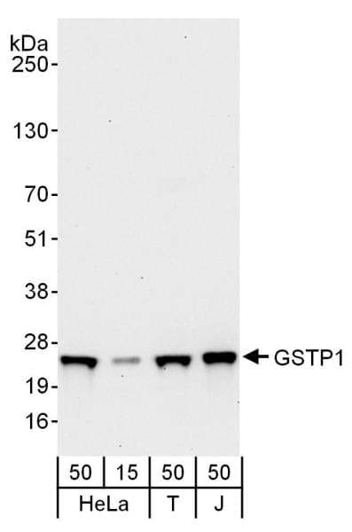 GSTP1 / GST Pi Antibody (aa160-210)