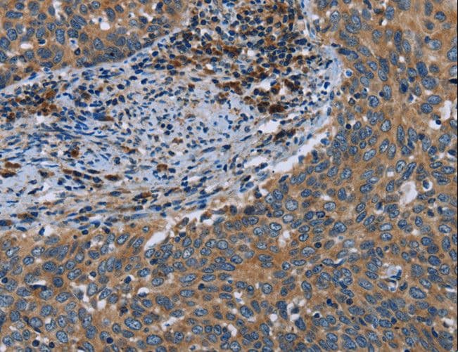 HYAL3 Antibody