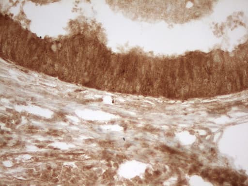 Monoclonal Mouse anti-Human PRMT5 Antibody (clone OTI4G7, aa238-499, IHC)