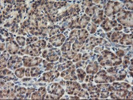 AGPAT5 Antibody (clone OTI1H10, Carrier-free)