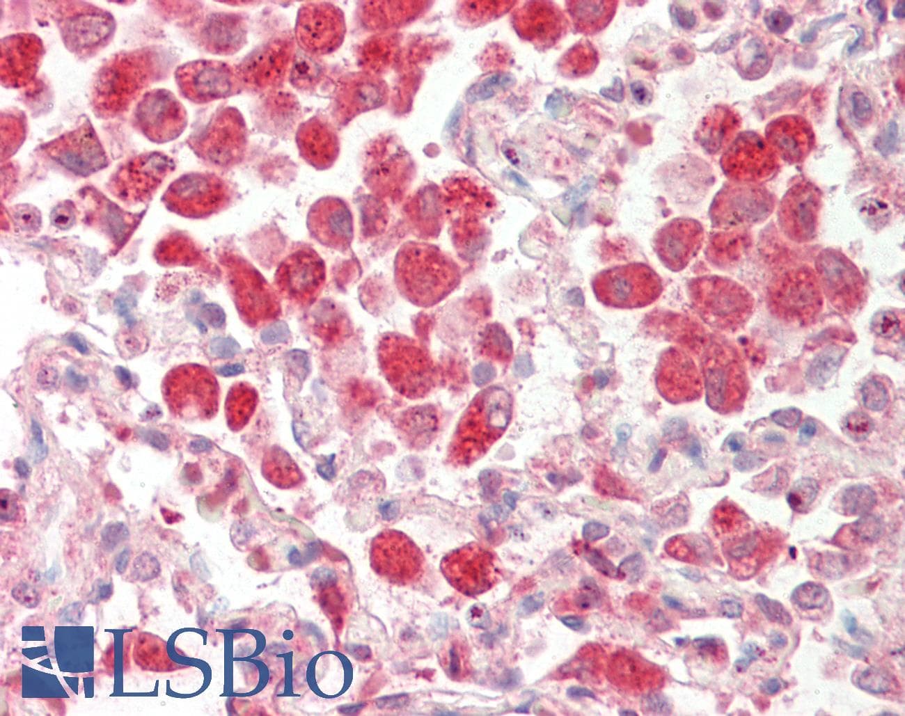 CTSZ / Cathepsin Z Antibody (aa21-70, Biotin)