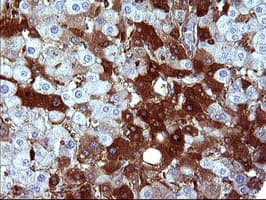 SERPINB3 Antibody (clone OTI1G9)