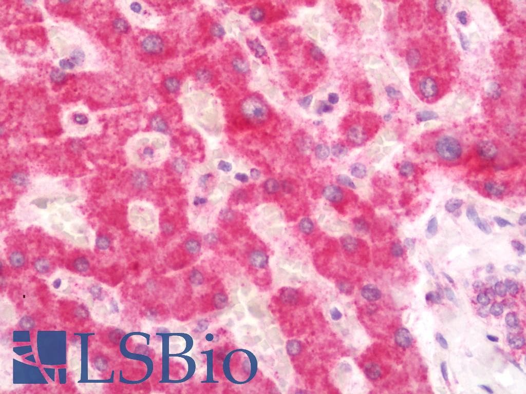 IHC-plus™ SKIV2L / SKI2 Antibody