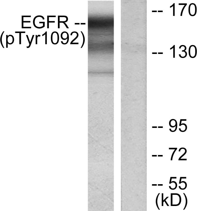 EGFR Antibody (phospho-Tyr1092)