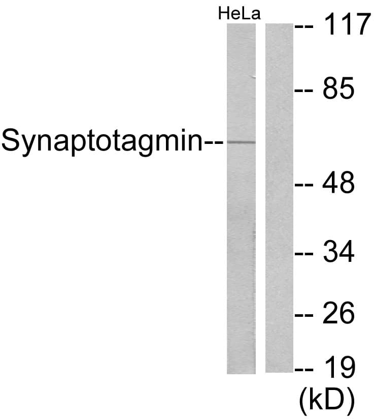 Polyclonal Rabbit anti-Human Synaptotagmin Antibody (aa176-225, IHC, WB)