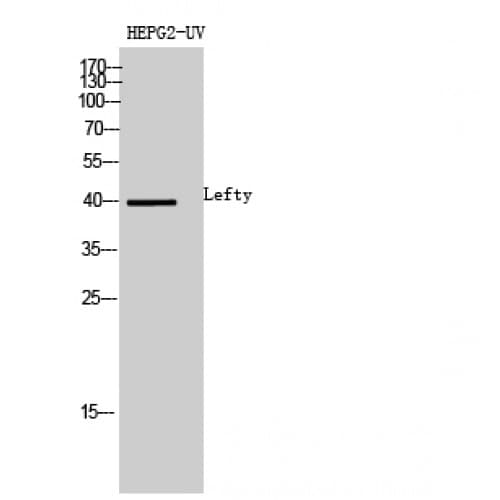 Polyclonal Rabbit anti-Human LEFTY1+2 Antibody (301-350 aa, C-terminal, WB)