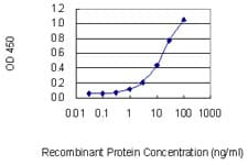 Treacle / TCOF1 Antibody (clone 8H3)