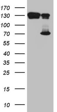 Monoclonal Mouse anti-Human TAF1B Antibody (clone OTI1A8, aa1-208, WB)