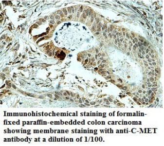 c-Met Antibody (aa586-601)