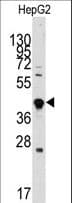 GDF3 Antibody (aa170-197)