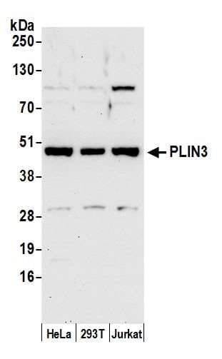 PLIN3 / M6PRBP1 / TIP47 Antibody (aa1-50)