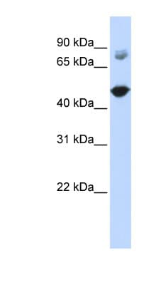 TBC1D16 Antibody (aa431-480)