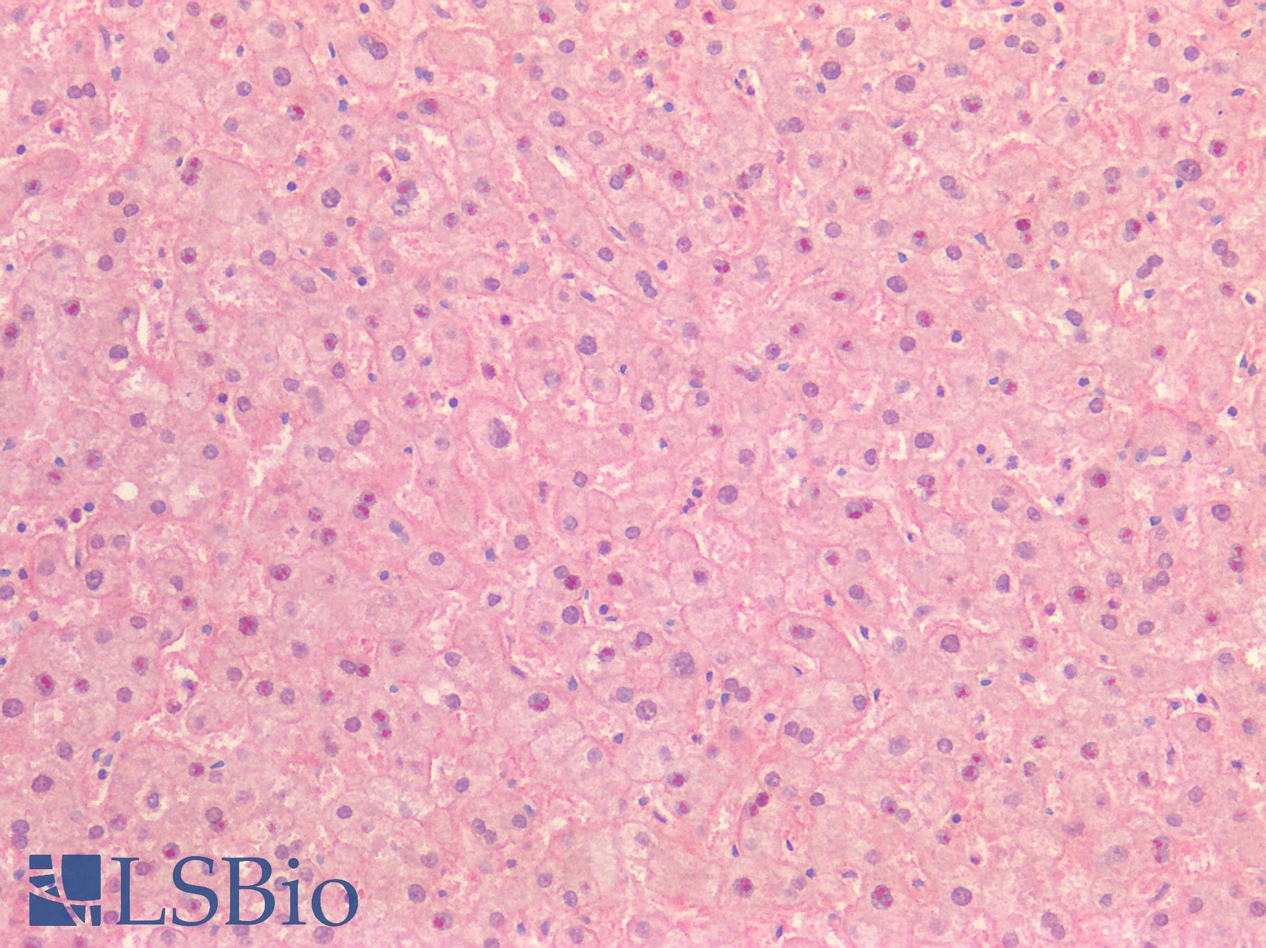 PathPlus™ Polyclonal Rabbit anti-Human INSR / Insulin Receptor Antibody (Internal, IHC)