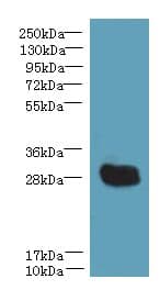 YIPF5 Antibody