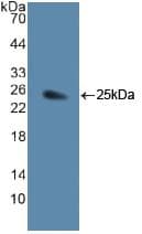 JAG1 / Jagged 1 Antibody (aa836-1047)
