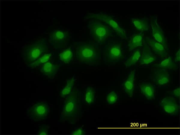 Monoclonal Mouse anti-Human CFL1 / Cofilin Antibody (clone 1A1, IHC, IF, WB)