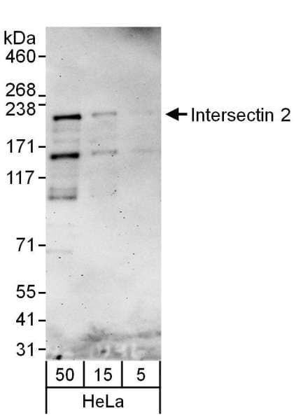 IHC-plus™ Polyclonal Rabbit anti-Human ITSN2 Antibody (aa550-600, IHC, WB)