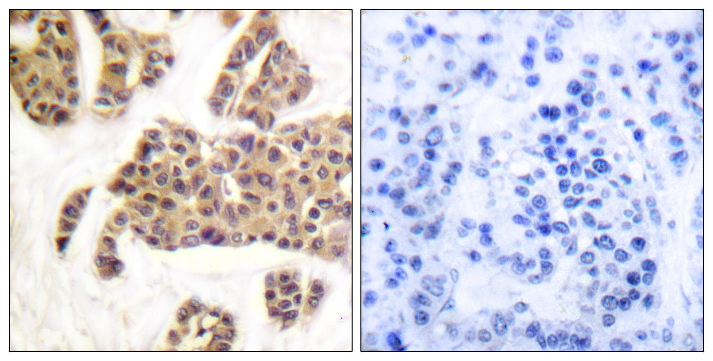 Polyclonal Rabbit anti-Human BAD Antibody (phospho-Ser91/128, IHC, WB)