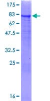 Human BLAP75 / RMI1 Protein (Recombinant GST)