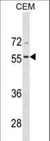 Polyclonal Rabbit anti-Human BMP8A Antibody (aa271-298, WB)