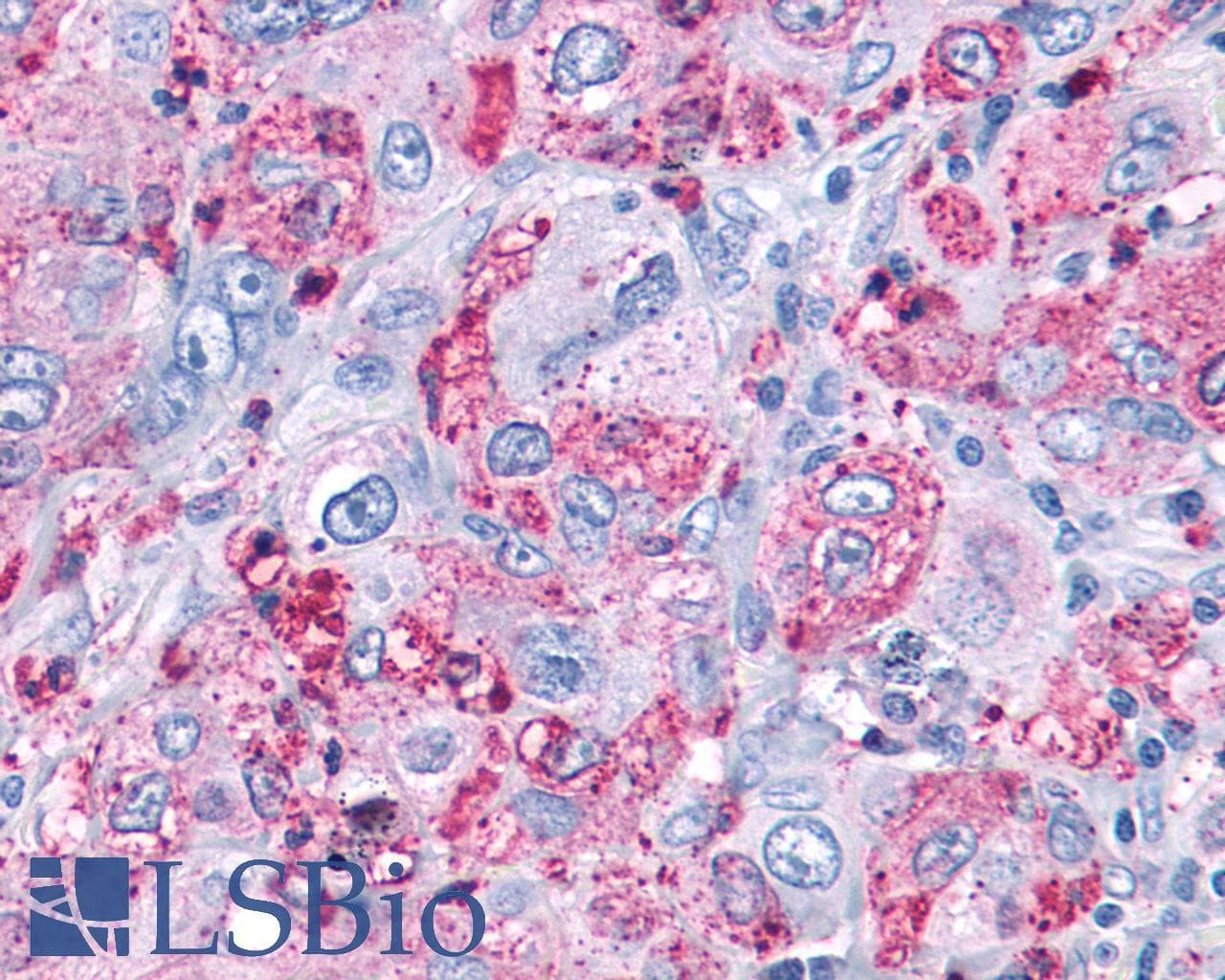 PathPlus™ MAS1 / MAS Antibody (Cytoplasmic Domain)