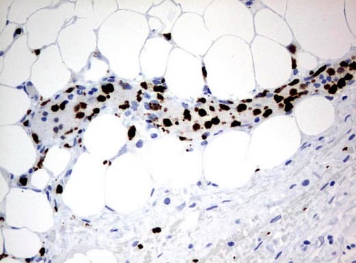 PBX1 Antibody (clone UMAB110)