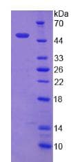 Human MTA2 Protein (Recombinant His)
