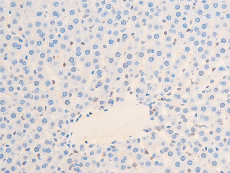 HSPB6 / HSP20 Antibody (phospho-Ser16)