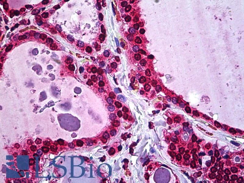 IHC-plus™ ATF5 Antibody (clone 4G5)