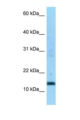 SDHC Antibody (aa59-108)