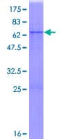 Human NIT1 Protein (Recombinant GST)