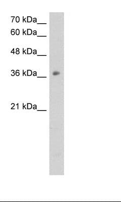 OTC Antibody (N-Terminus)