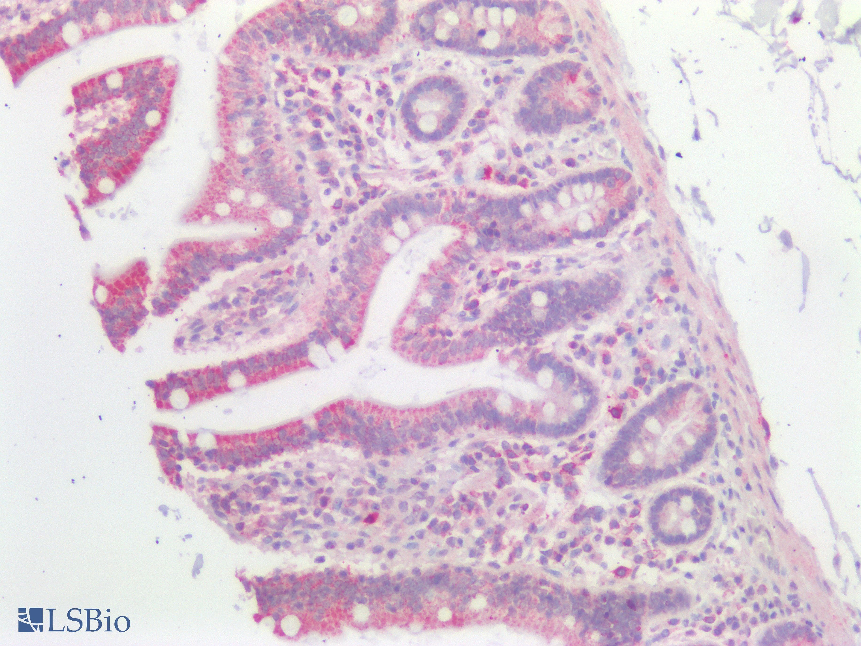 PathPlus™ Polyclonal Rabbit anti-Human GNAQ Antibody (IHC)