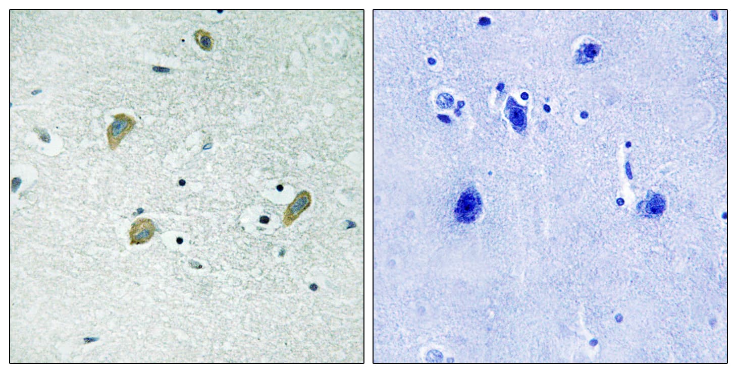 CKI-Gamma 1+2+3 Antibody