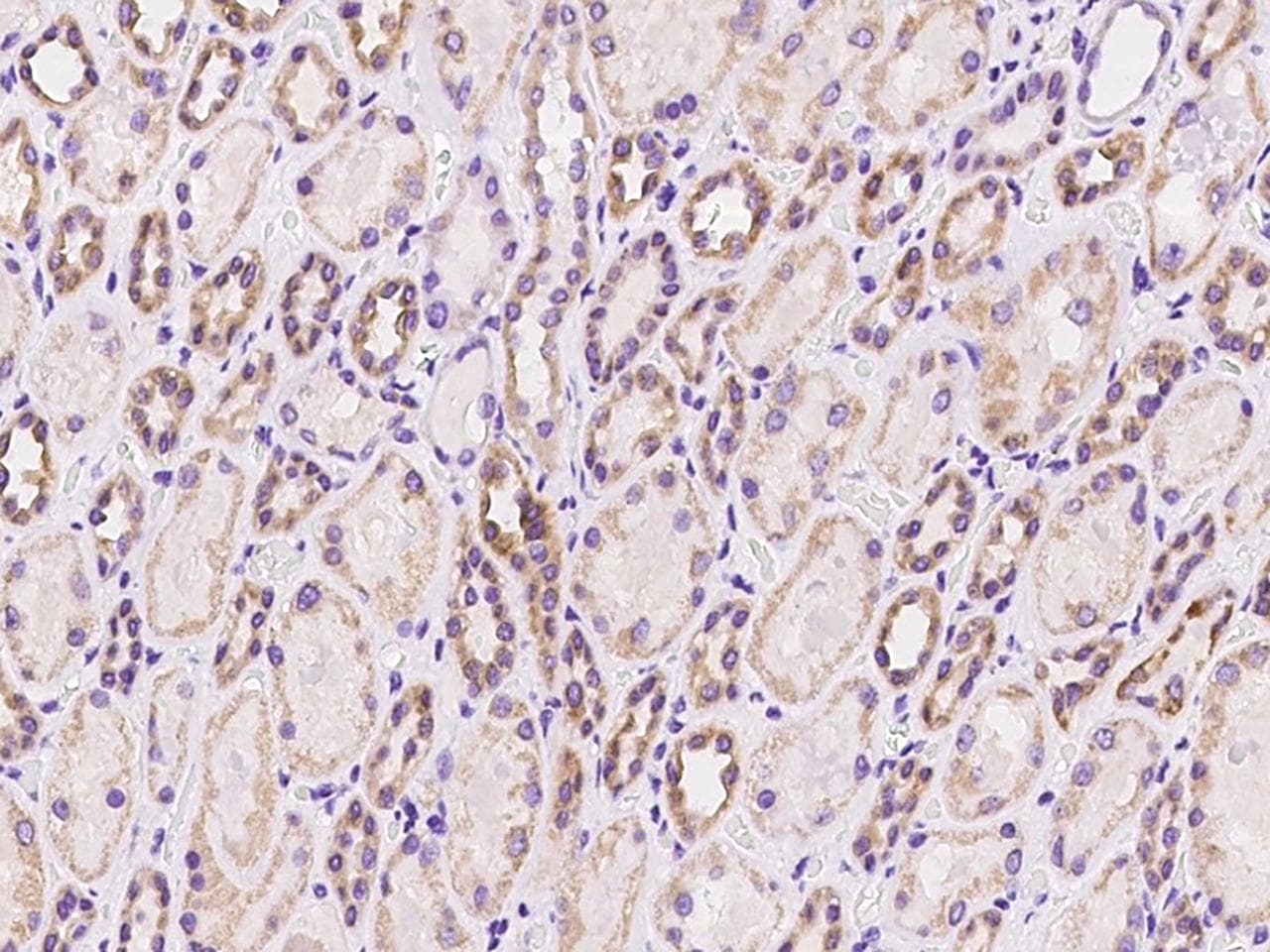 CHCHD5 Antibody