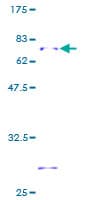 Human HSD17B2 Protein (Recombinant GST)
