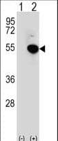 IRF4 Antibody (aa164-191)