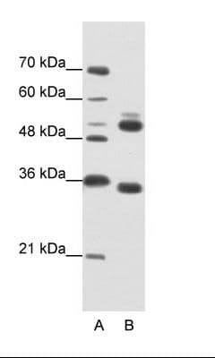 WDR6 Antibody (aa334-383)