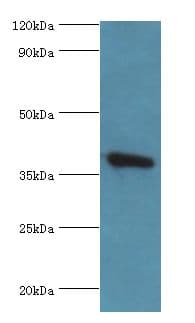 ANXA2 / Annexin A2 Antibody (aa2-339, Biotin)