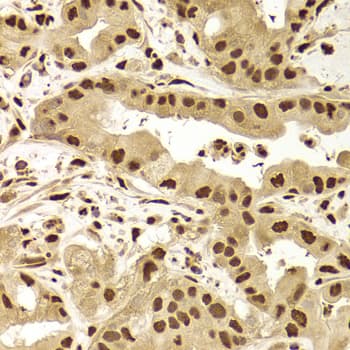 PHAP1 / ANP32A Antibody