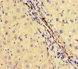 OTUB1 / OTU1 Antibody