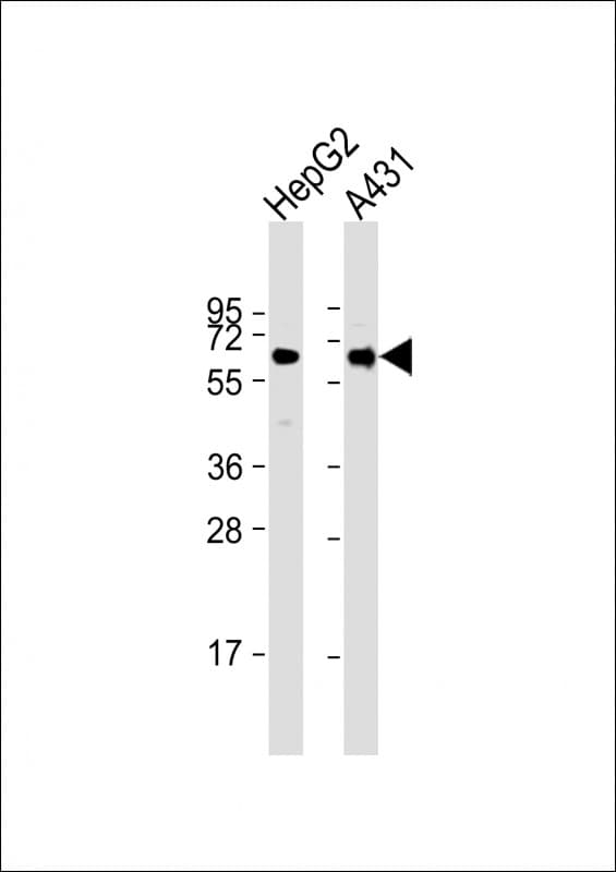 Monoclonal Mouse anti-Human TERF2IP / RAP1 Antibody (clone 1664CT768.14.43, IHC, WB)