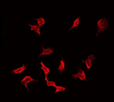 VASP Antibody (phospho-Ser157)