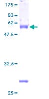 Human FHL2 Protein (Recombinant GST)