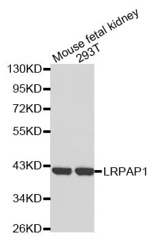 IHC-plus™ LRPAP1 Antibody