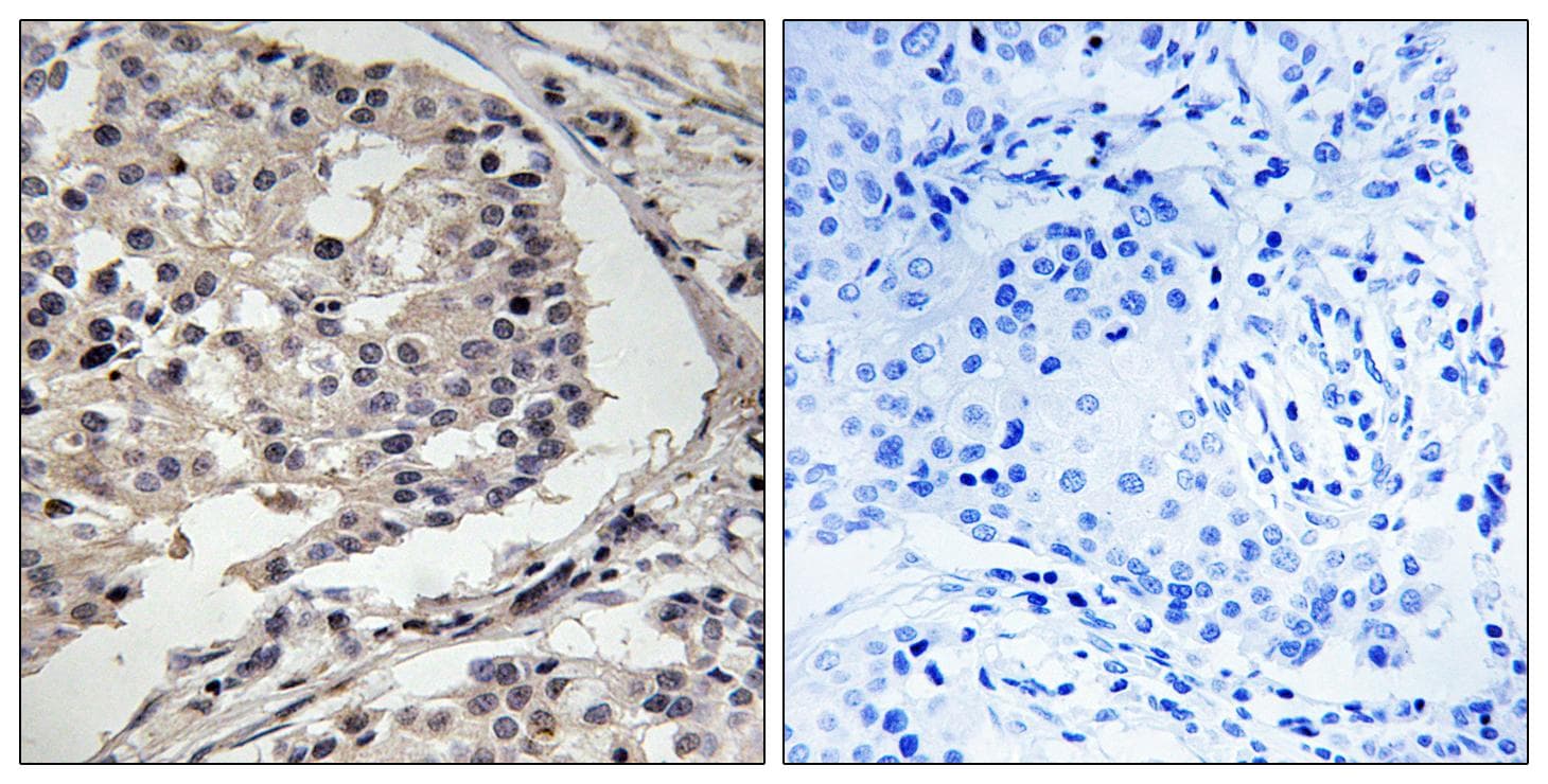 MLK1+2 Antibody (Ab-312/266)